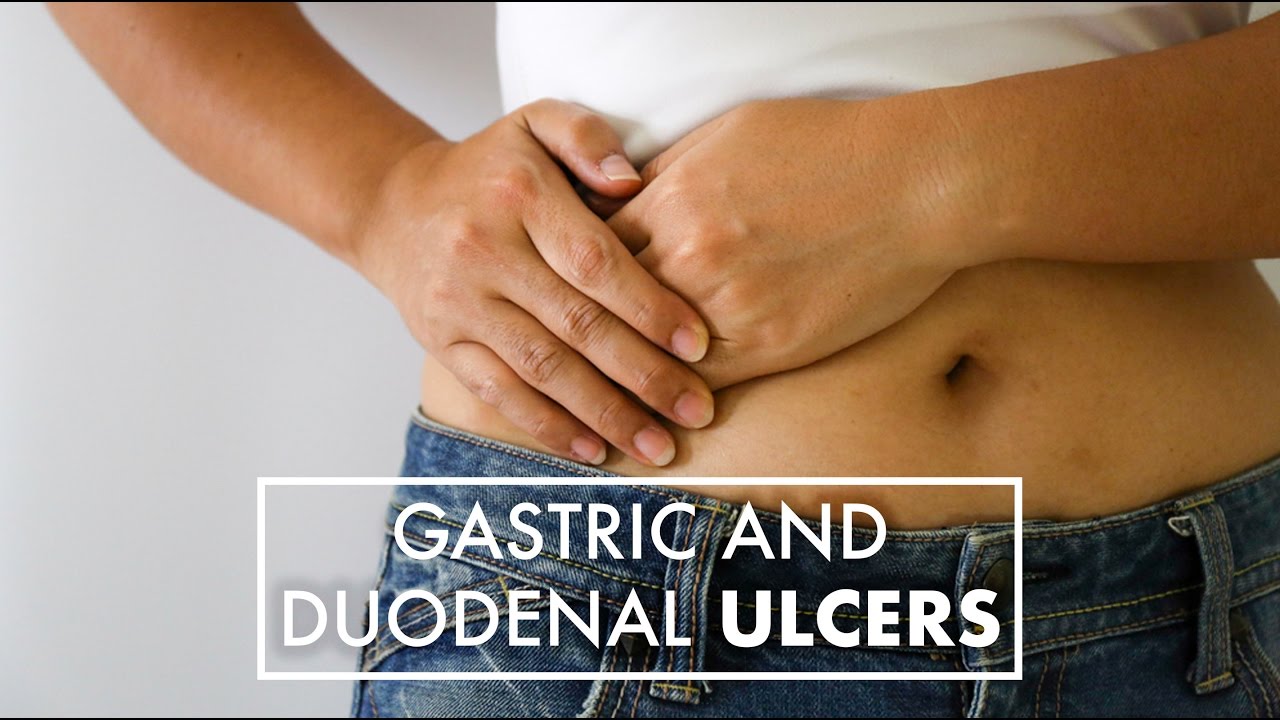 Gastric Ulcers vs. Duodenal Ulcers | Dr. Jeffrey Linder | Top10MD