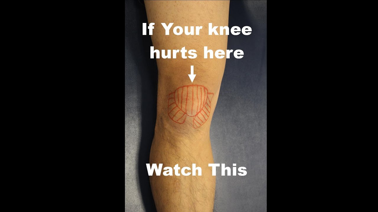 What you can do at home to help with pain in the front of your knee - Patellofemoral Pain Syndrome
