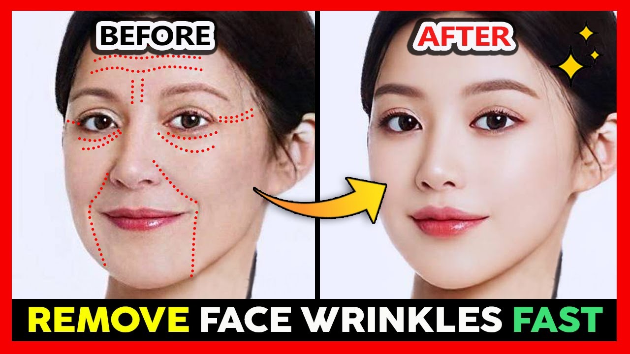 Remove Face Wrinkles Quickly | Anti-Aging Face Massage for Deep Wrinkles, Look Younger