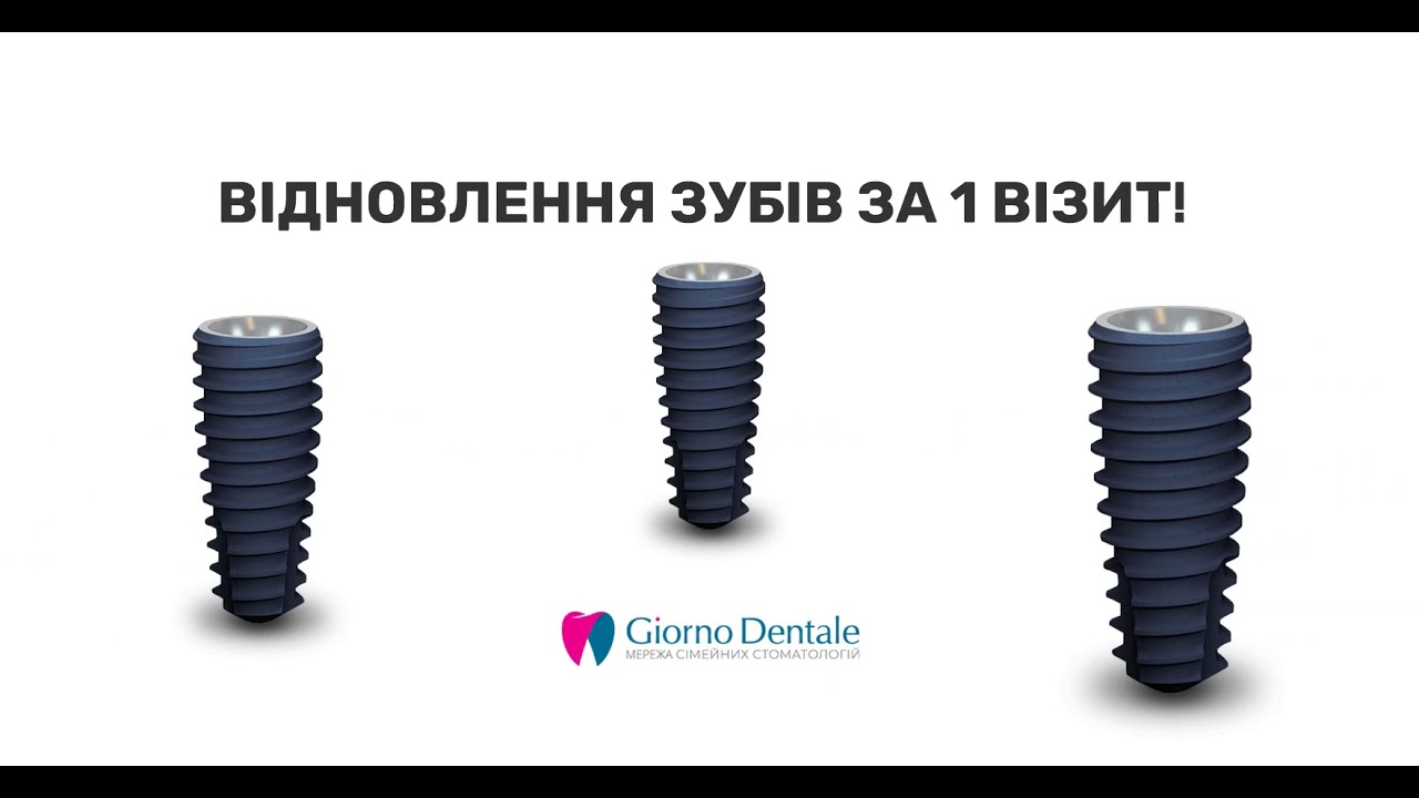 Импланты Megagen. Имплантация зубов, стоматология Giorno Dentale. Мегаджен - клиника Джорно Дентале