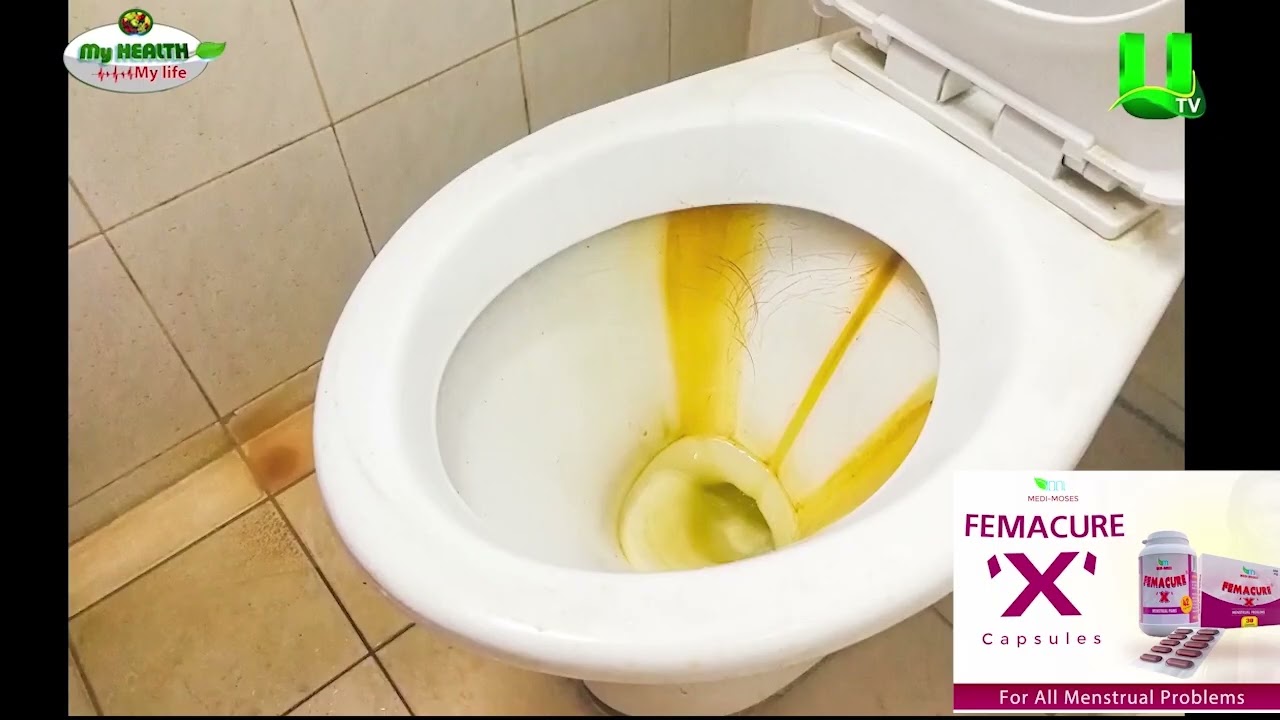 My Health My Life  Causes And Implications Of Painful Urination 1