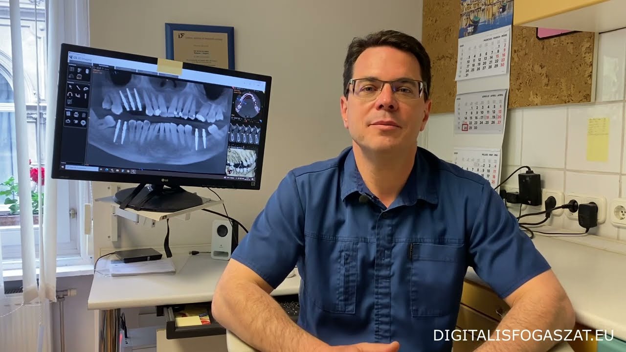 💥Fáj e az implantáció❓Őszintén az implantációról Dr. Kelemen Péterrel