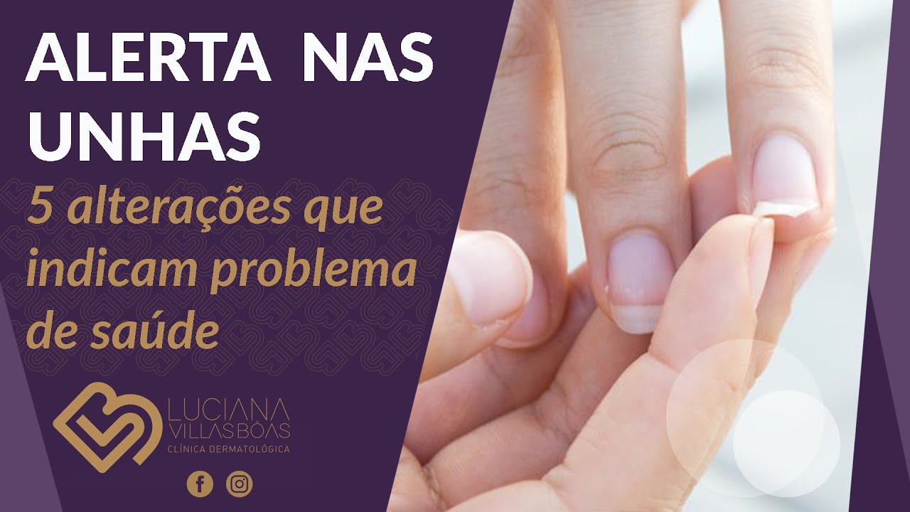 5 sinais nas unhas que podem indicar problemas de saúde!
