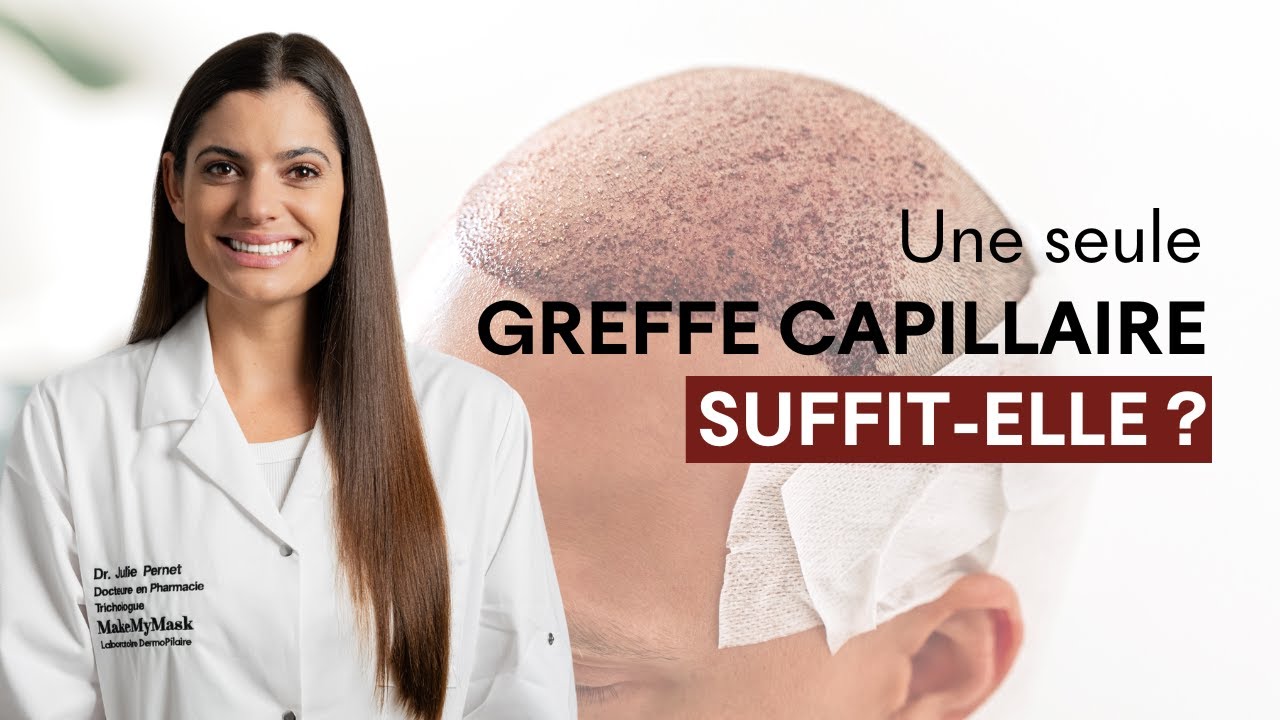 Une seule greffe capillaire suffit-elle ?