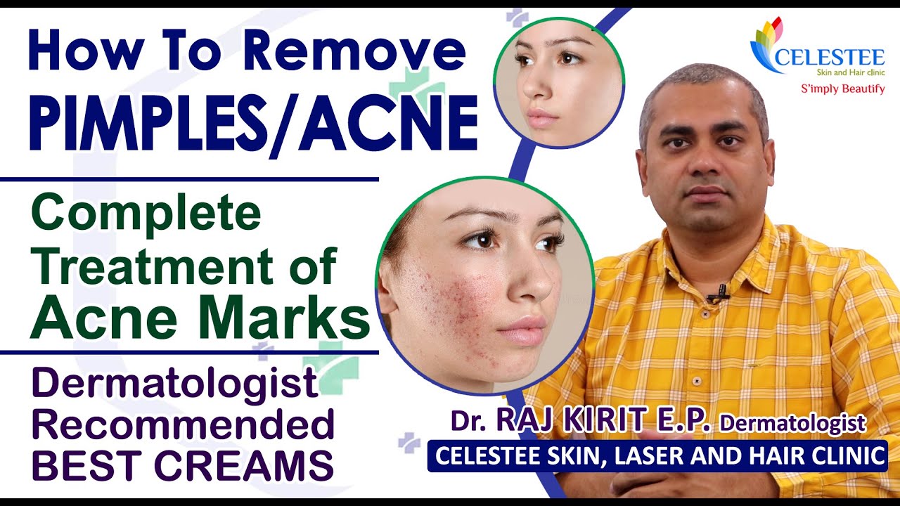 How To Remove Pimples/Acne | Complete Treatment of Acne Marks | Best Medicine For Acne | healthdesk
