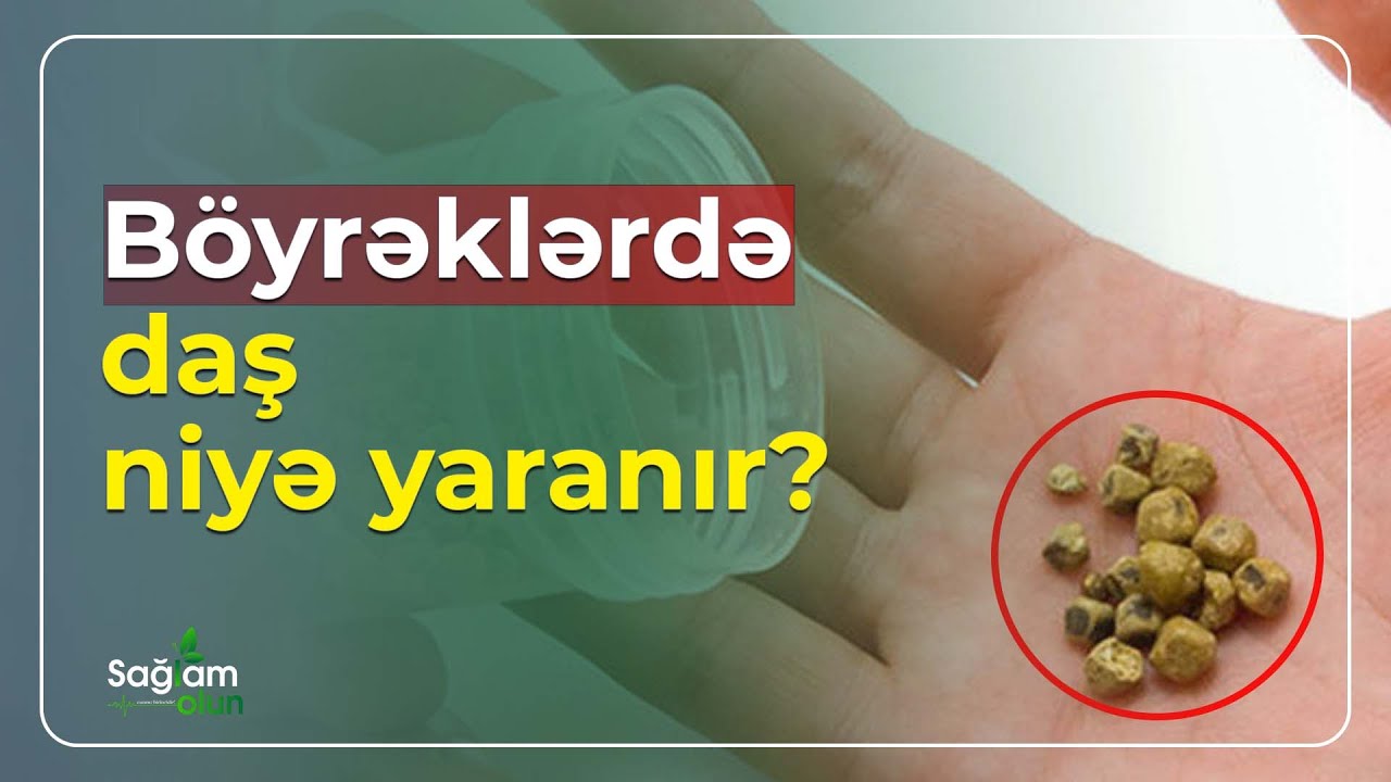 Böyrək daşı olanlar necə qidalanmalıdırlar? - Sağlam Olun (20.06.2023)