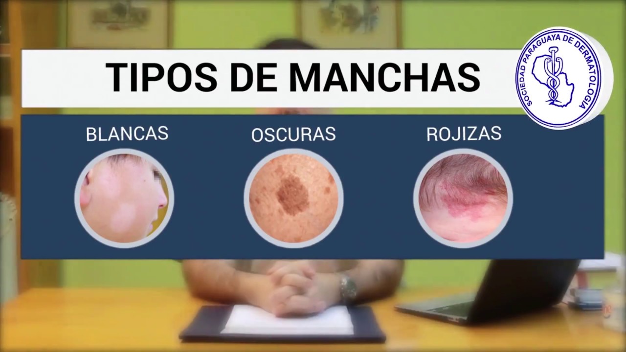 MANCHAS EN LA PIEL
