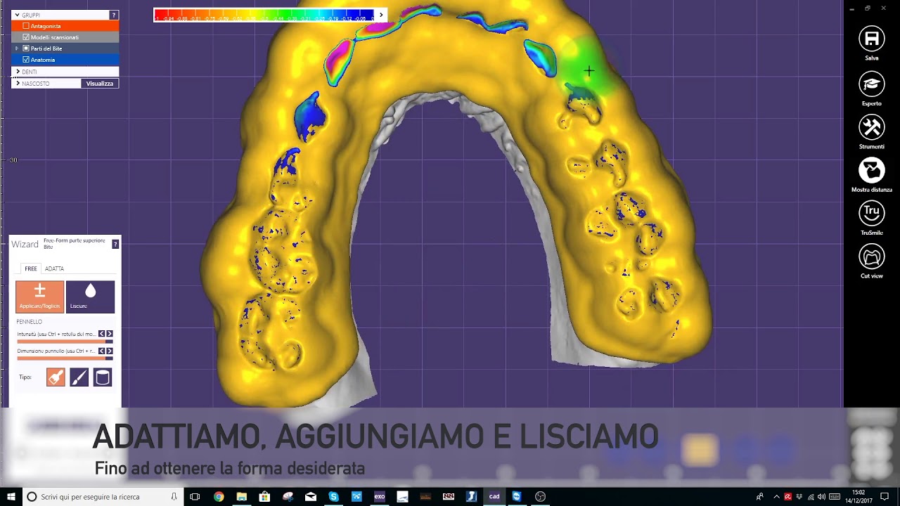 Realizziamo un bite