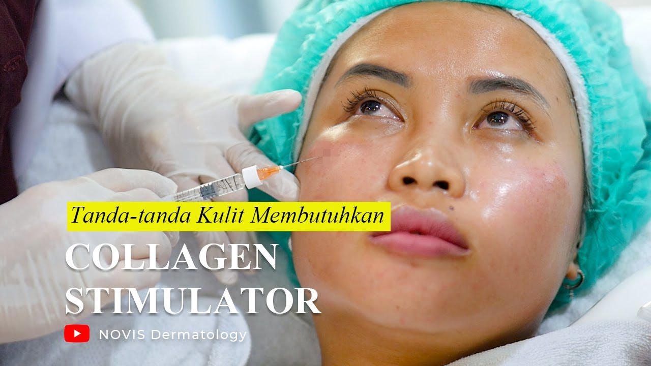 Tanda-tanda Kulit mu membuthkan COLLAGEN STIMULATOR!! || NOVI'S Dermatology