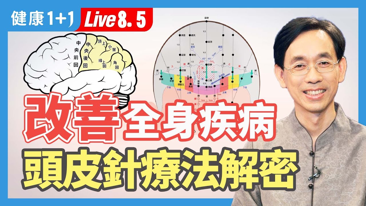 《自然》雜誌「生物全息律」理論，證實了頭皮針功效，頭皮針應用廣泛，可治療很多疾病，分爲四類，中樞神經系統，精神障礙，疼痛與感覺異常，外感與內臟功能失調。| （2023.08.05）健康1+1 · 直播
