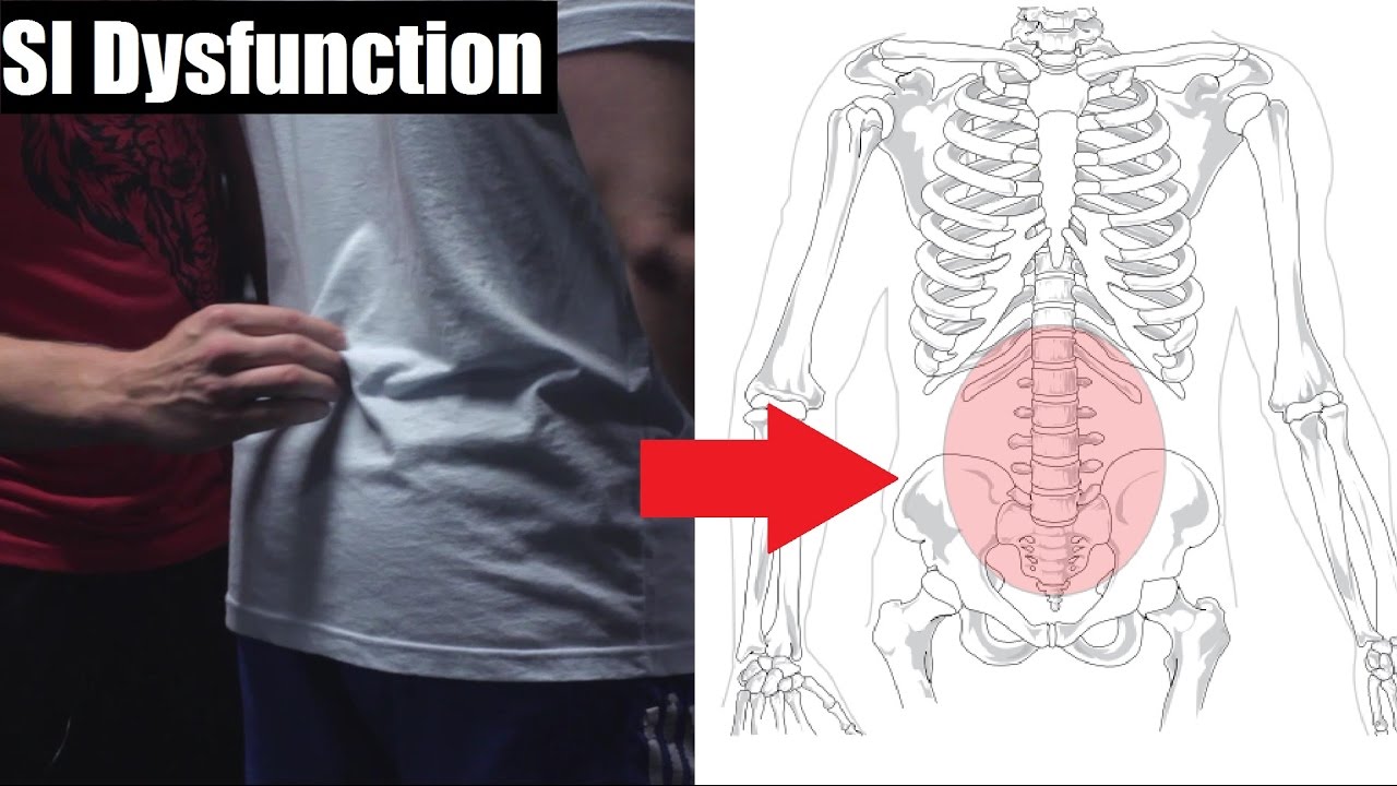 FIXING MY BROKEN BACK: SI Joint Dysfunction Rehab/Prehab (Ft. Jake Noel)