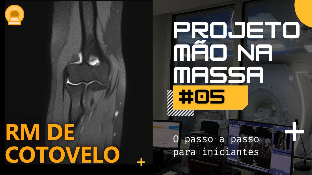 Projeto Mão Na Massa 05 | Planejamento RM de Cotovelo