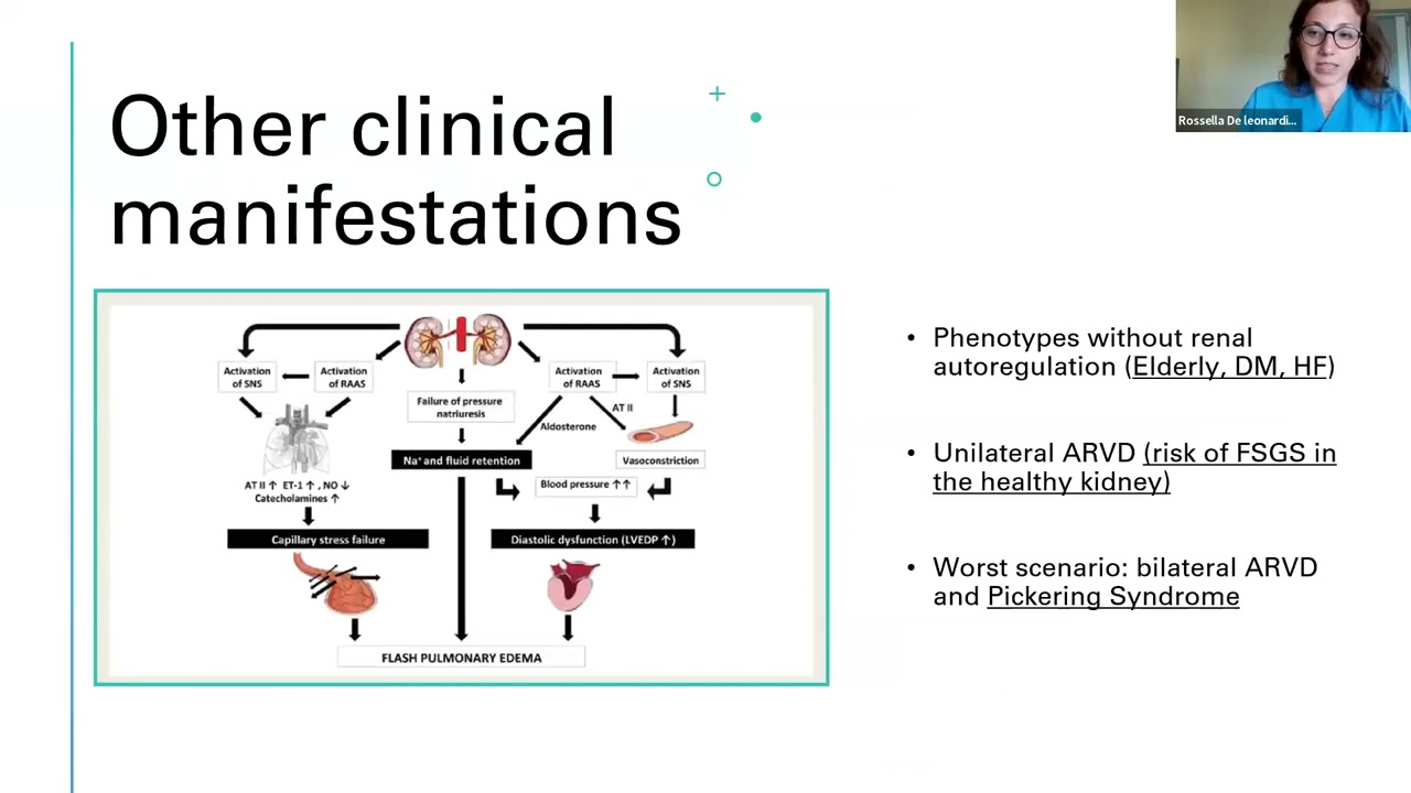 JOURNAL CLUB: ATHEROSCLEROTIC RENO-VASCULAR DISEASE (ARVD)