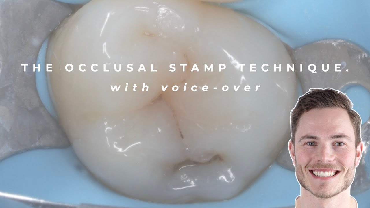 The Occlusal Stamp Technique (voice-over)