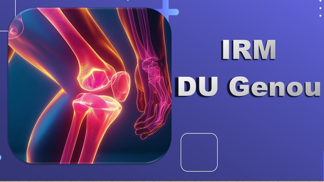 IRM DU Genou -Bonne Pratique_