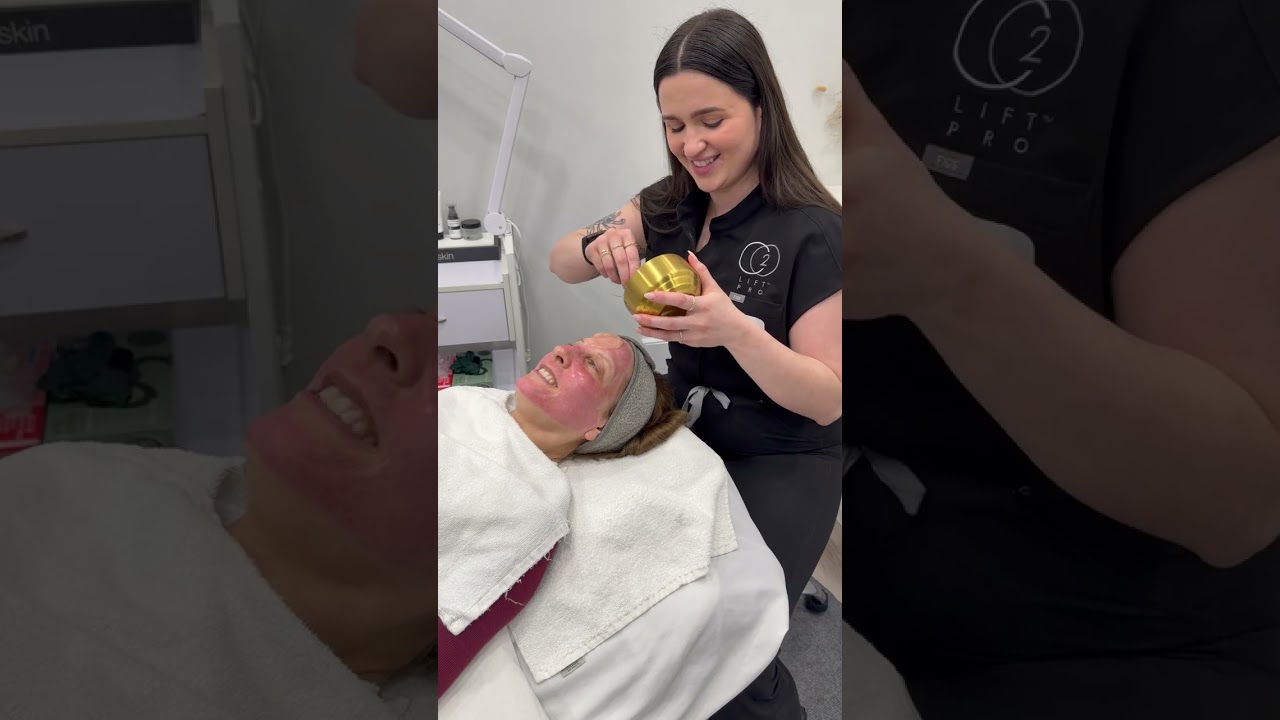 CO2 Lift Treatment Live Demo | Carboxytherapy Facial at GLOW Beauty Bar