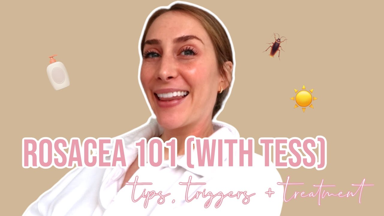 ROSACEA 101: Tips, Triggers + Treatments from an Esthetician + Expert.