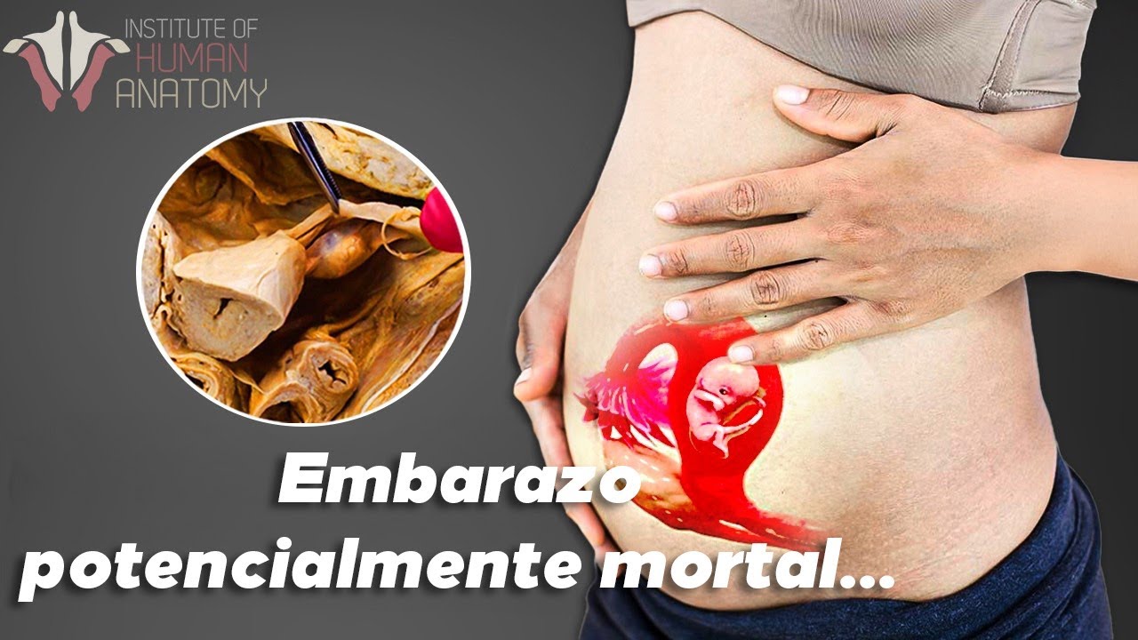&iquest;Qu&eacute; es un embarazo ect&oacute;pico y por qu&eacute; es tan peligroso?