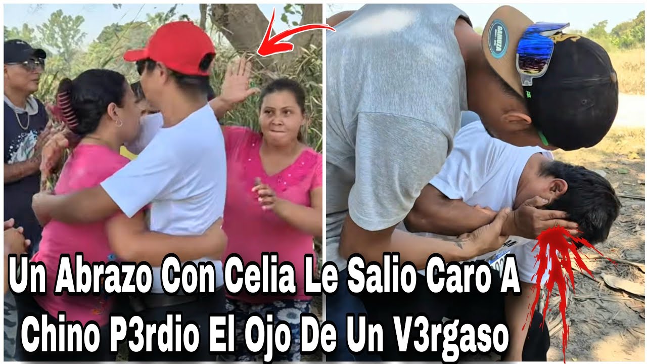 Chino Pedia A Gritos Ayud4 Dee Un Descuido Darly De Un Cuent4zo Le S'aco El Ojo A Chino😢