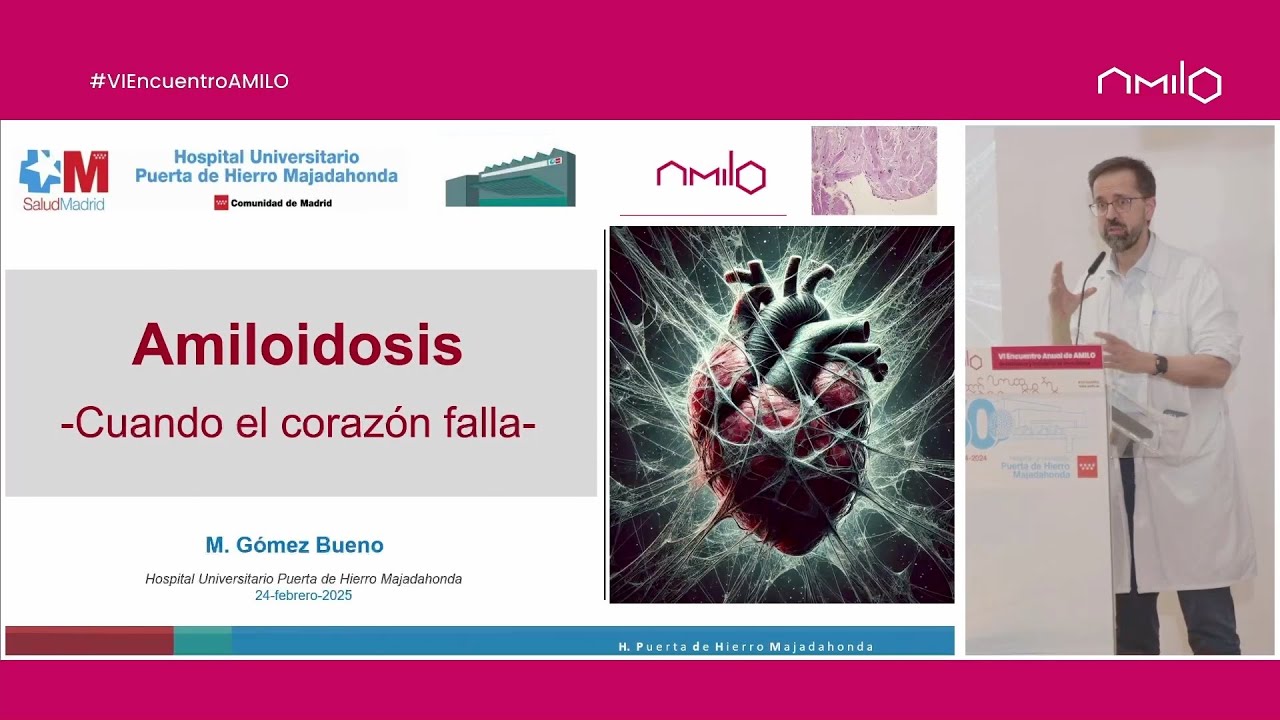 Ponencia: Cuando el corazón falla por la amiloidosis - Dr. D. Manuel Gómez Bueno