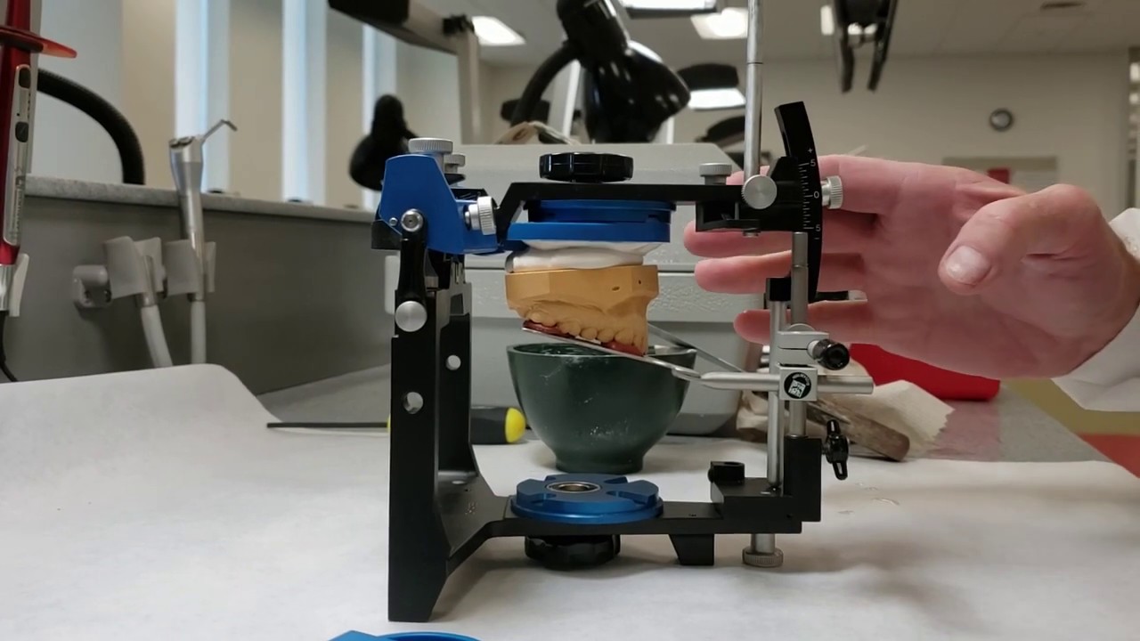 Mounting the Maxillary Cast on Articulator - Dr. Mark R. Taylor