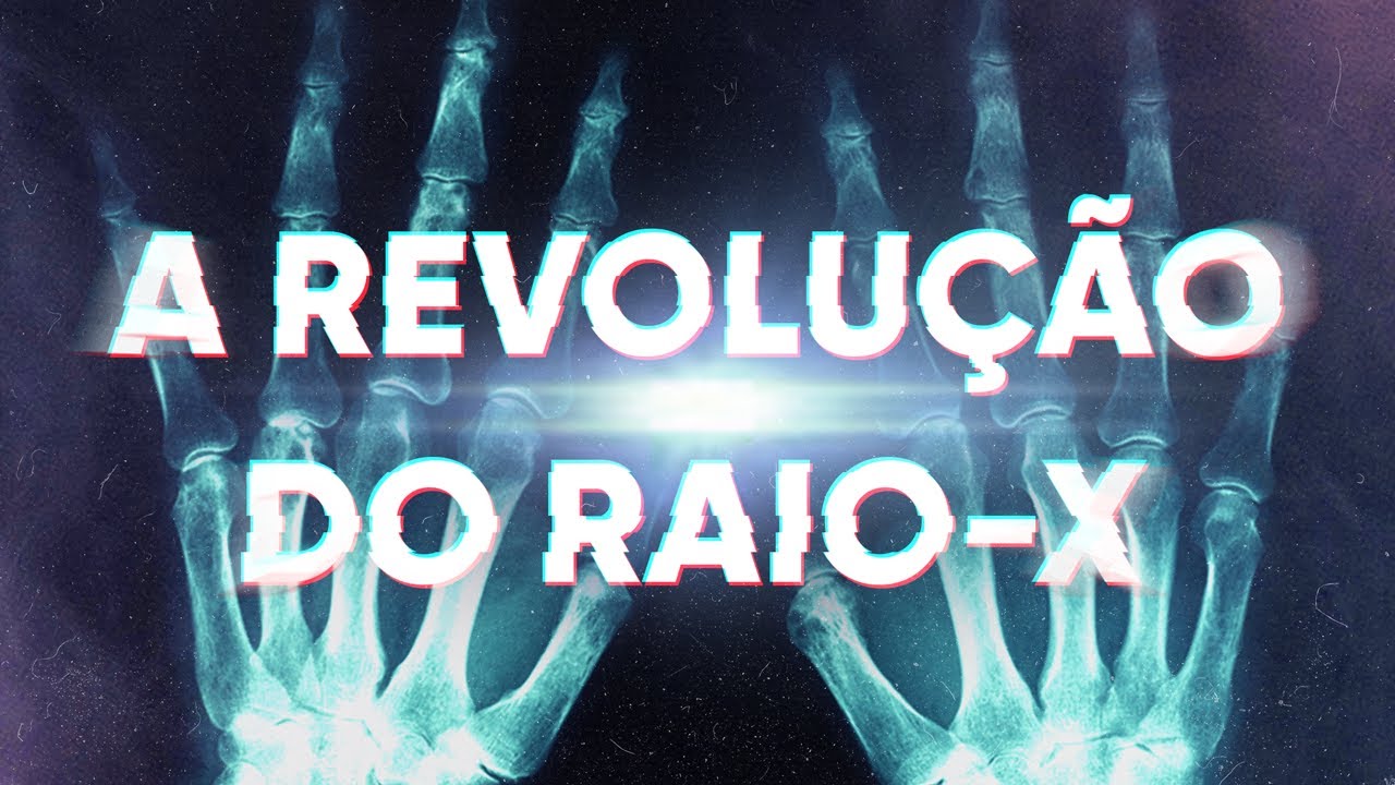 A Revolução do Raio X