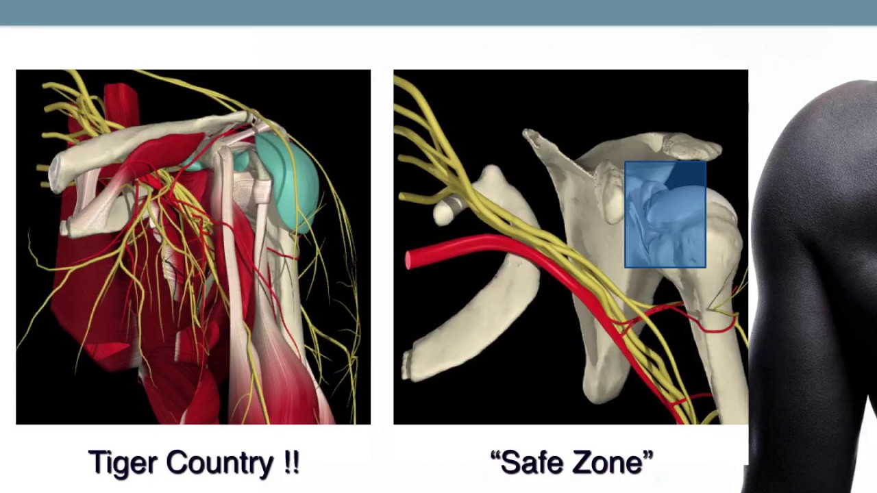 Tips for Basic Shoulder Arthroscopy Part 2- Diagnostic Routine