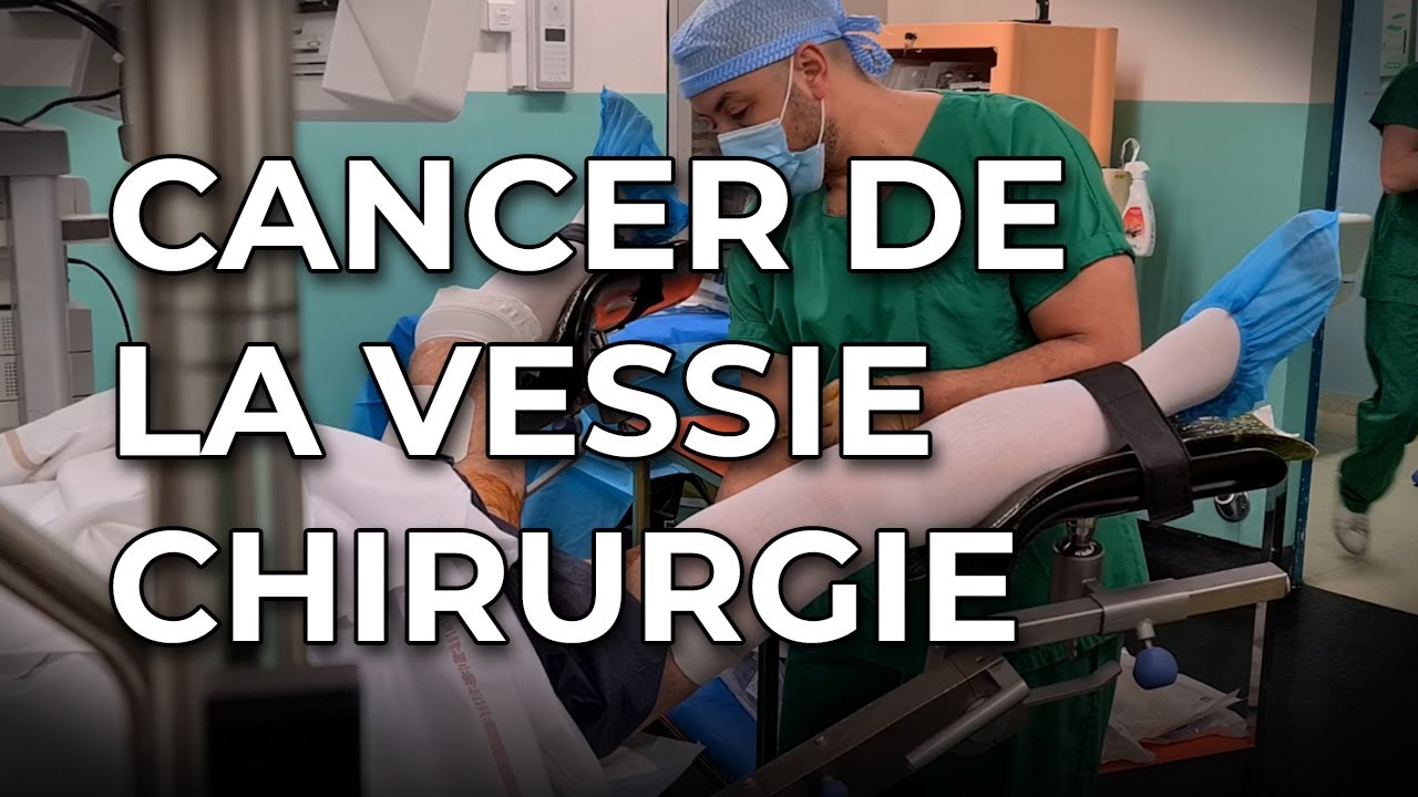 Cancer de la vessie : des techniques opératoires pour limiter la récidive et améliorer le traitement