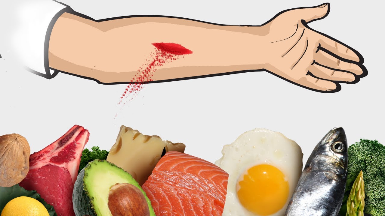 Top 5 Foods to Heal Wounds Faster.