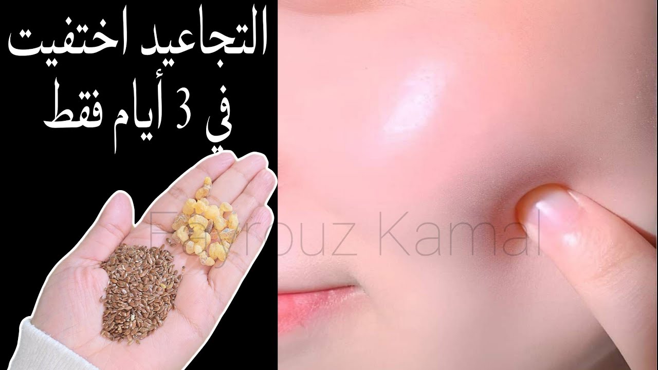 لبان الذكر_لإخفاء التجاعيد ولتفتيح البشره في ثواني لن تصدقي النتائج