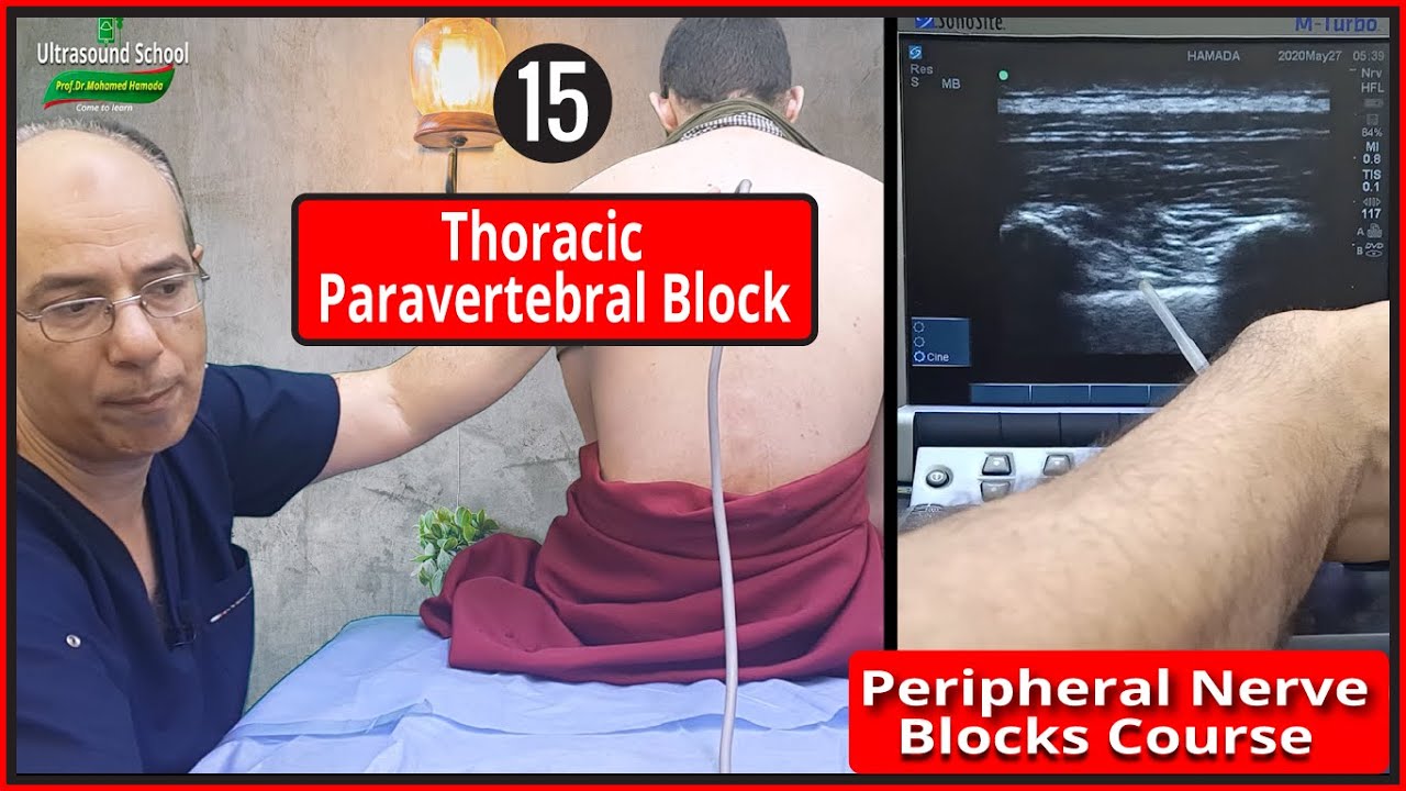 Thoracic Paravertebral Block)Ultrasound Guided peripheral Nerve Blocks Course |Mohamed Hamada|(15)