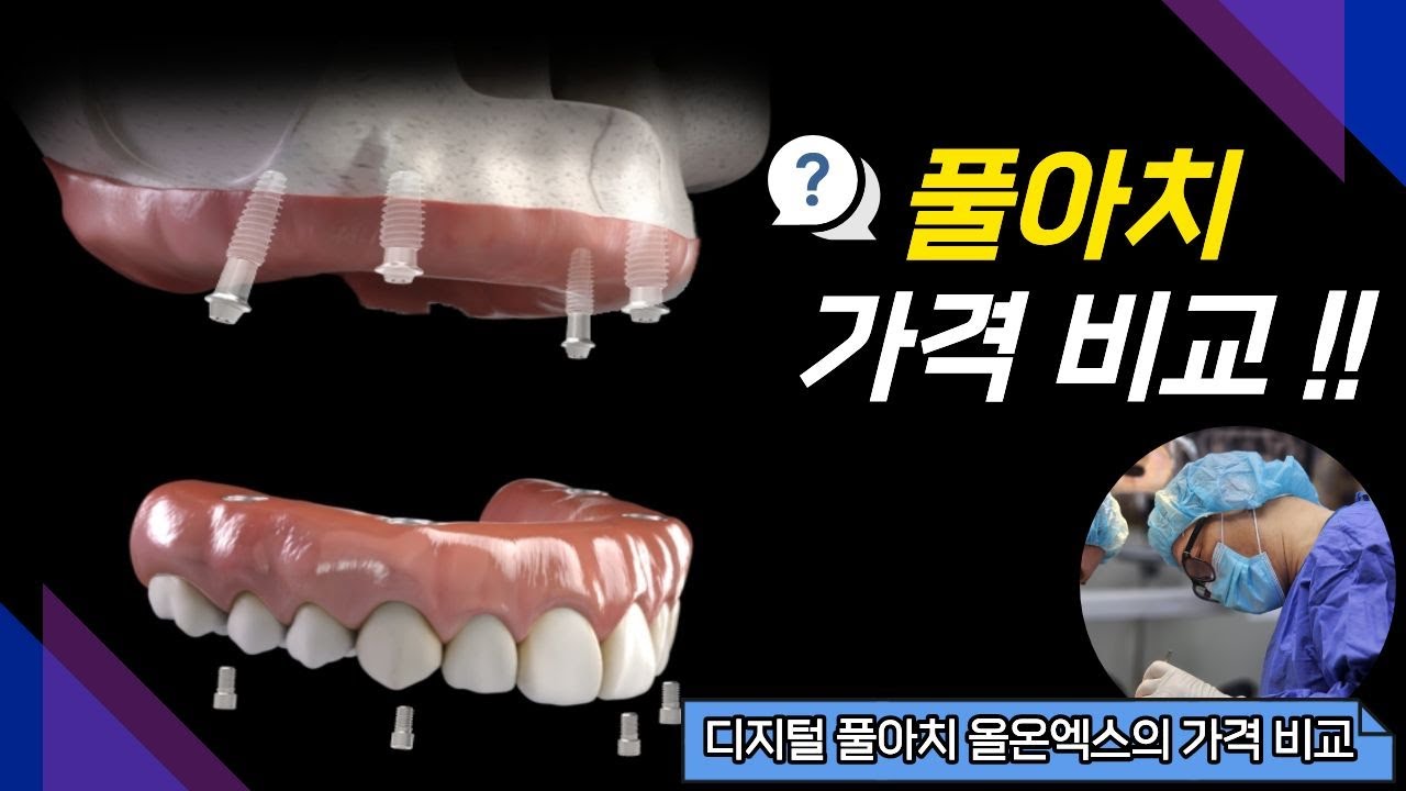 디지털 풀아치 올온엑스의 가격 얼마가 합리적일까요?