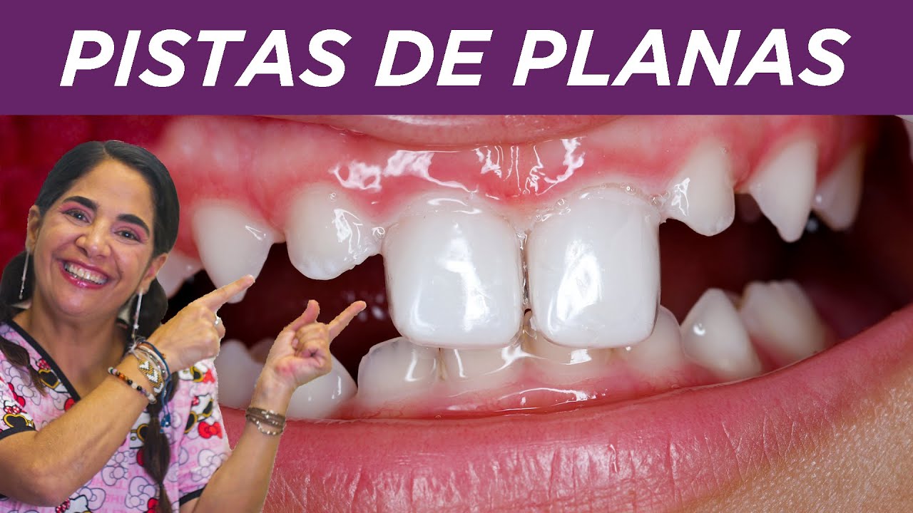 Pistas de planas