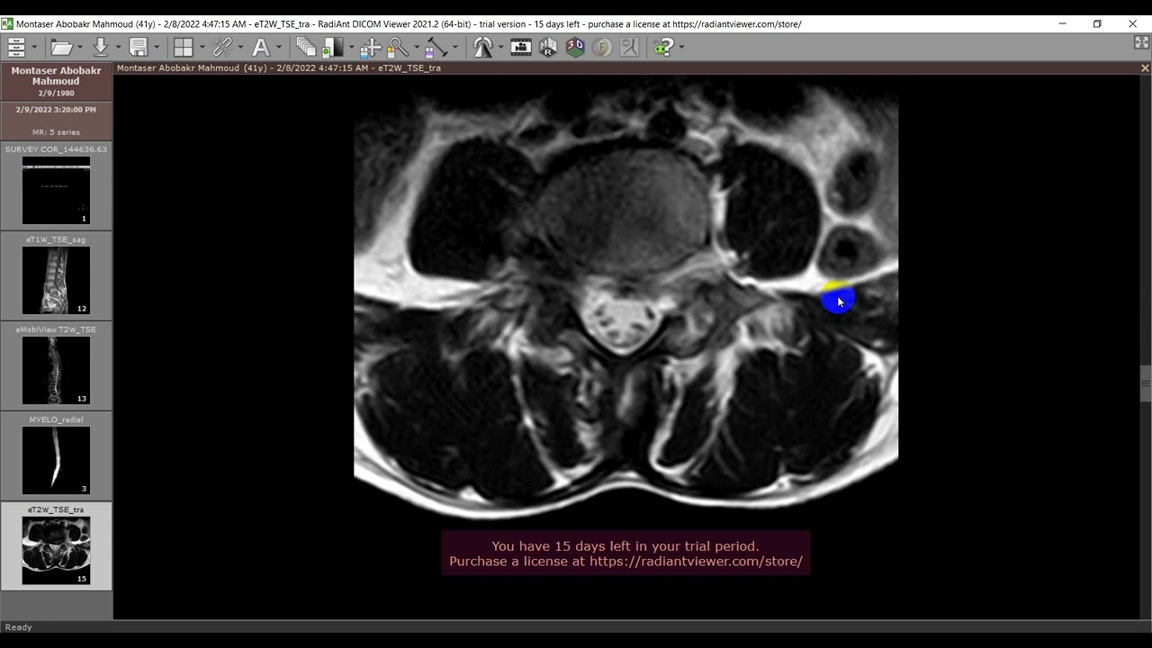 cases 5