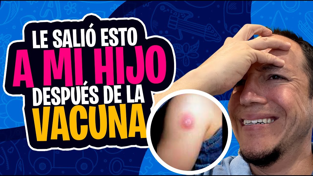 Le pusieron la vacuna BCG a mi bebé  y se le puso feo el brazo