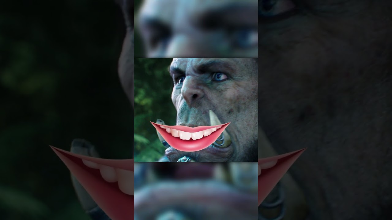 Подбородочный.
