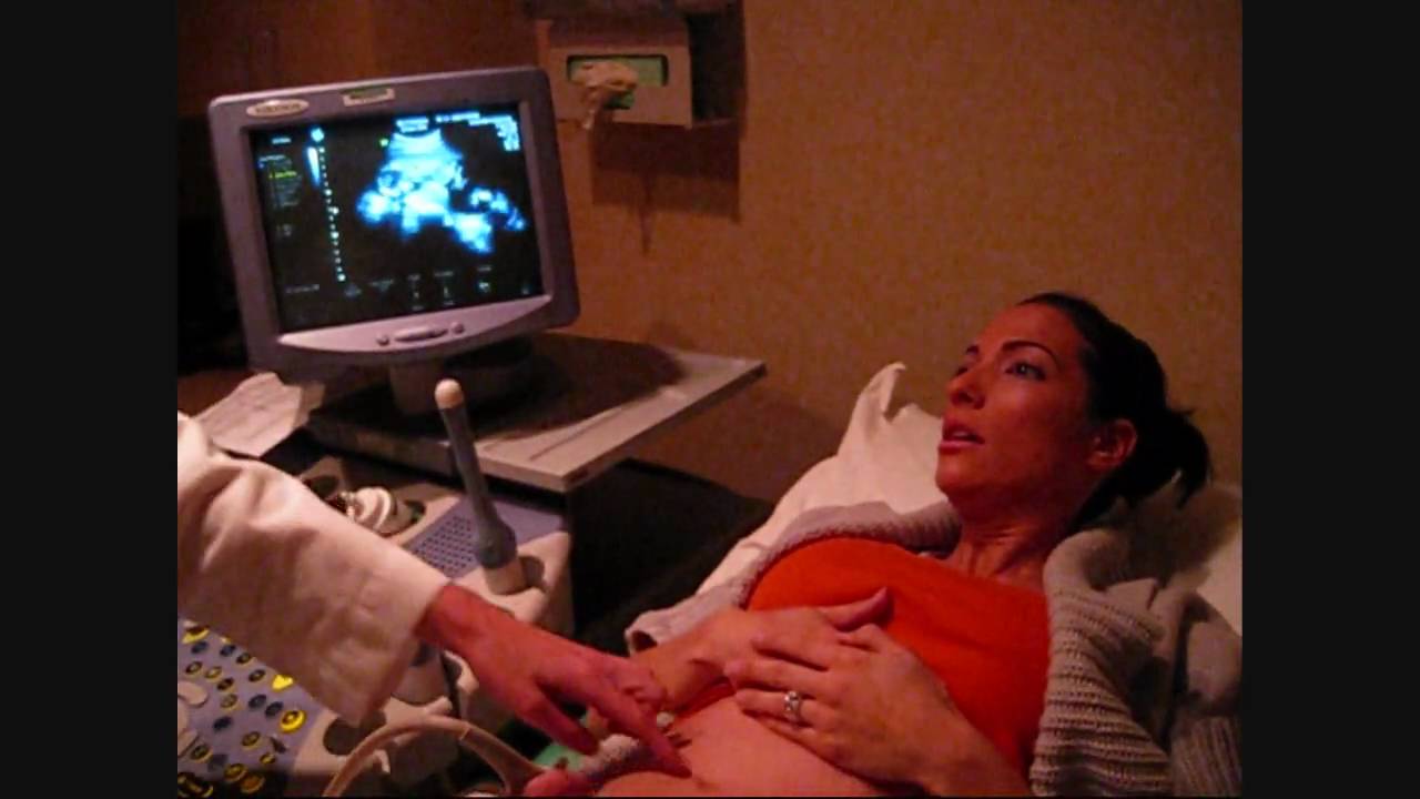 Mom To Be Finds Out That She Is Having TWINS!!!
