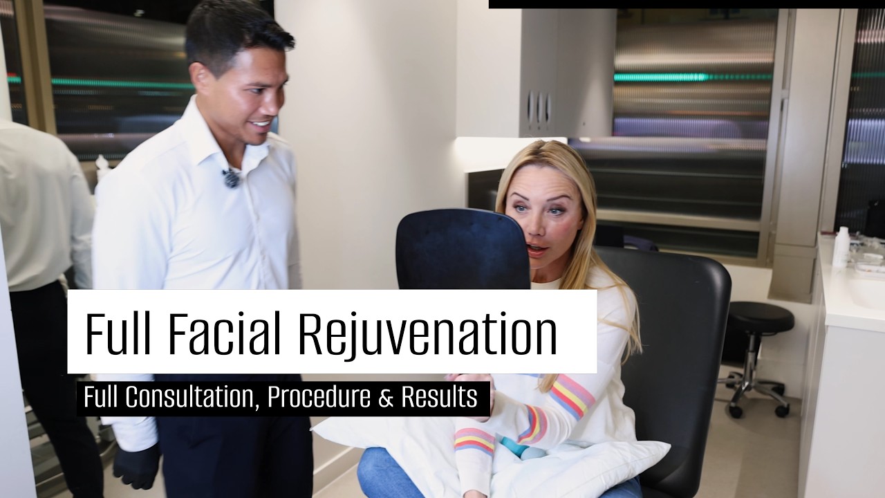 Full Facial Rejuvenation with Dermal Fillers | Natural Looking Results