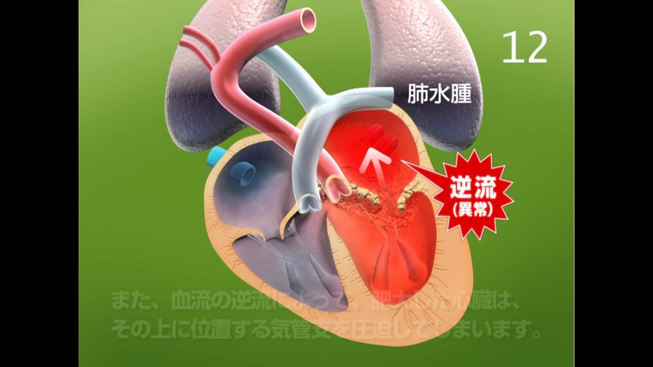 犬の心不全　第４章　慢性心不全症の心臓