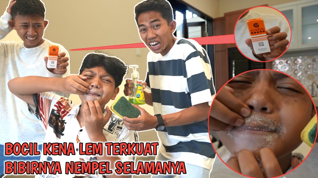 YA AMPUN BIBIR BOCIL KENA LEM SAMPE GAK BISA DIBUKA??😱 Arik Panik | Mikael TubeHD