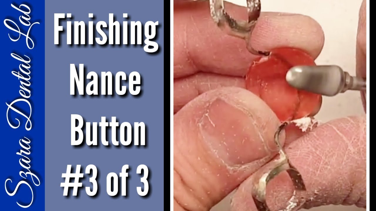 Nance Button Finishing Ortho lesson #3 of 3 Szara Dental
