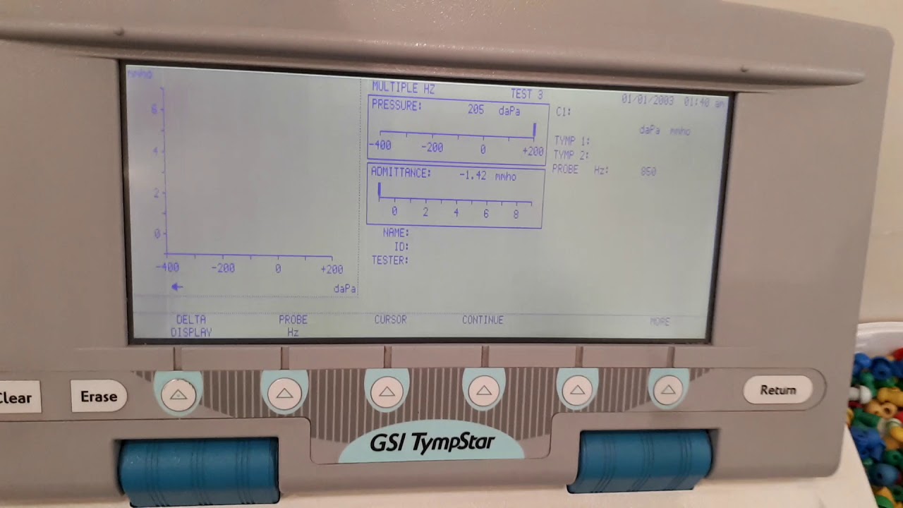 Multiple Frequency Tympanometry_多頻鼓室圖操作