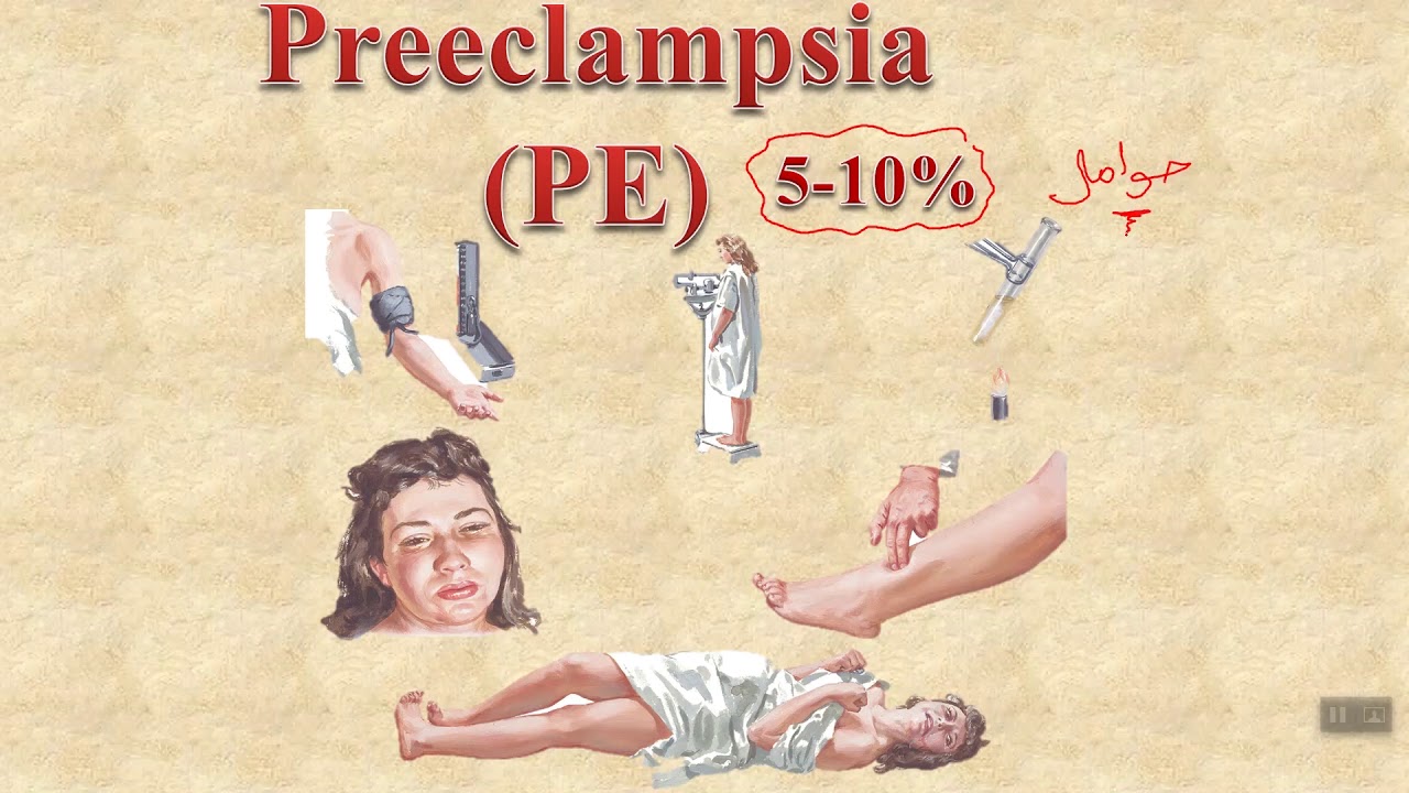 Preeclampsia part 1
