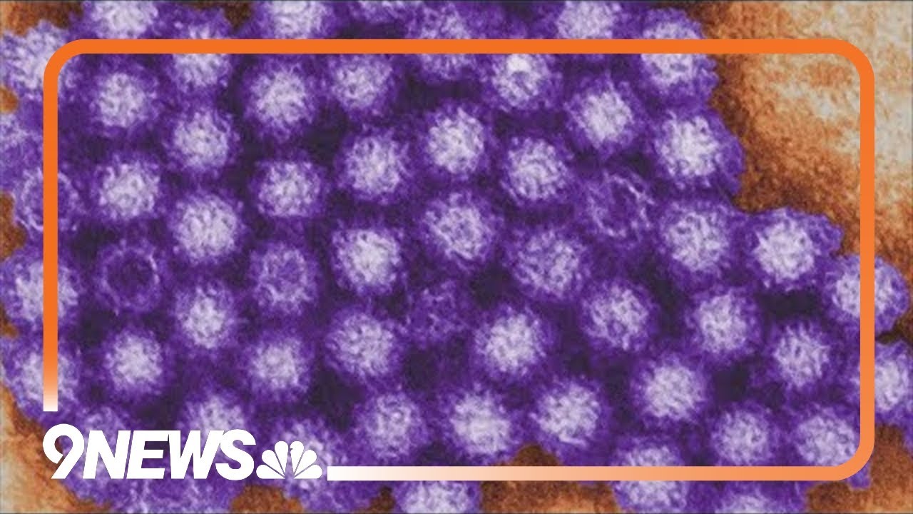 How to kill the norovirus