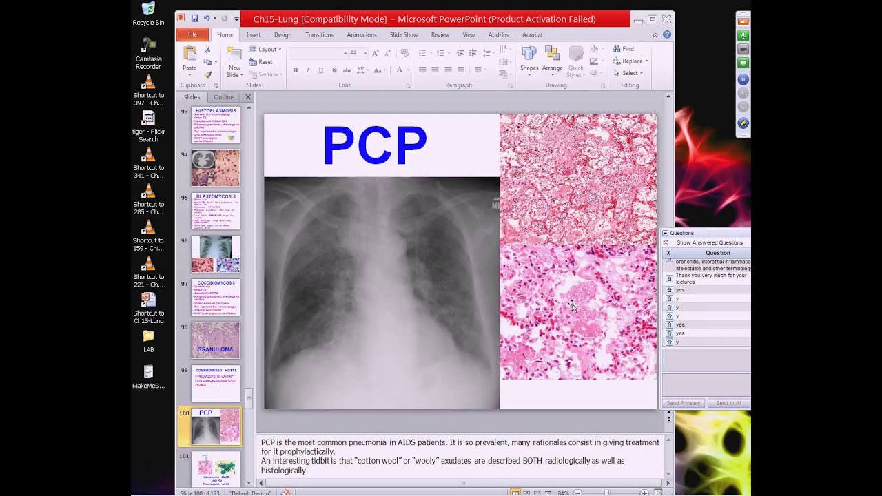 Medical School Pathology, 2013 Season, Session #57: Lung-III