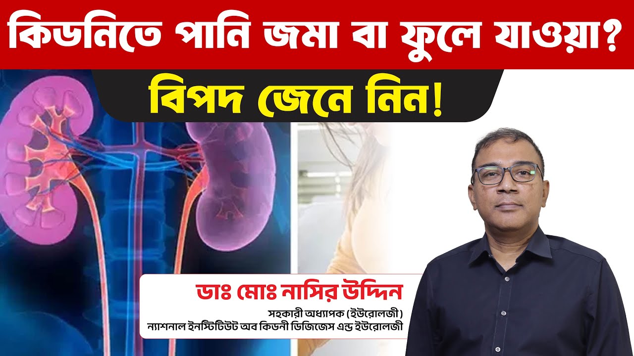 Hydronephrosis বা কিডনিতে  পনি জমা রোগ টা আসলে কি ?কেন  হয়  ? চিকিৎসা কি ? PUJO#P-6.