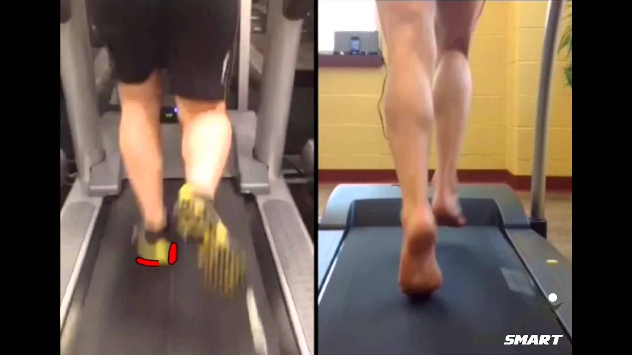 Is Pronation Bad For Runners? | RunSmartOnline.com