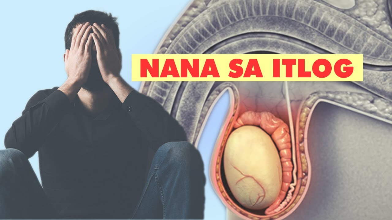 [Q&A] LUMALABAS NA NANA SA BAYAG, BATO SA PANTOG, BUKOL SA ITLOG, SPIRULINA ATBP.