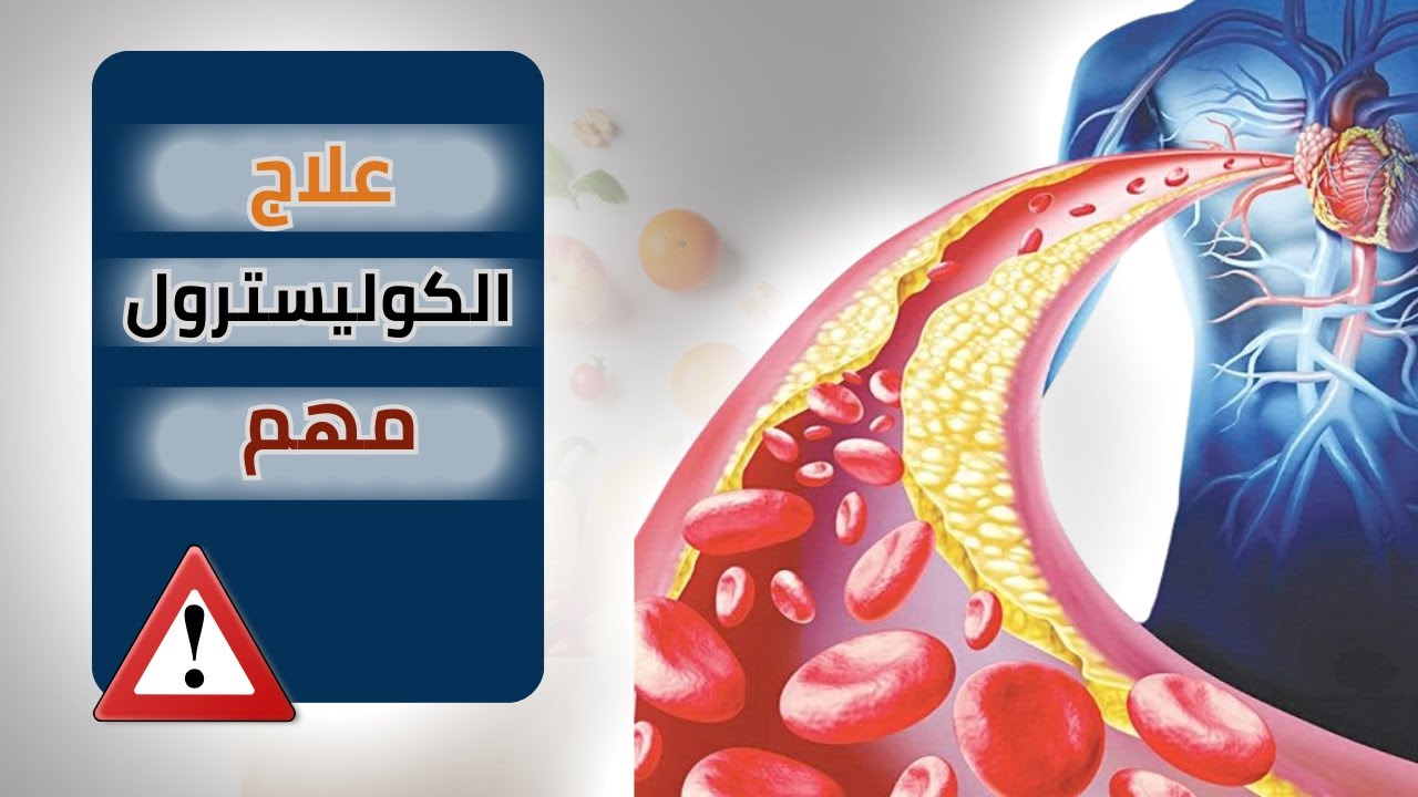 الكوليسترول والدهون الثلاثية: أخطاء شائعة تدمر صحتك دون أن تشعر