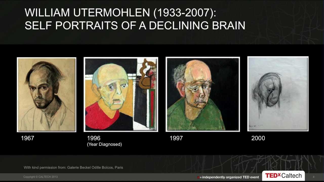 Treating brain diseases -- overcoming the blood-brain barrier: Devin Wiley at TEDxCaltech